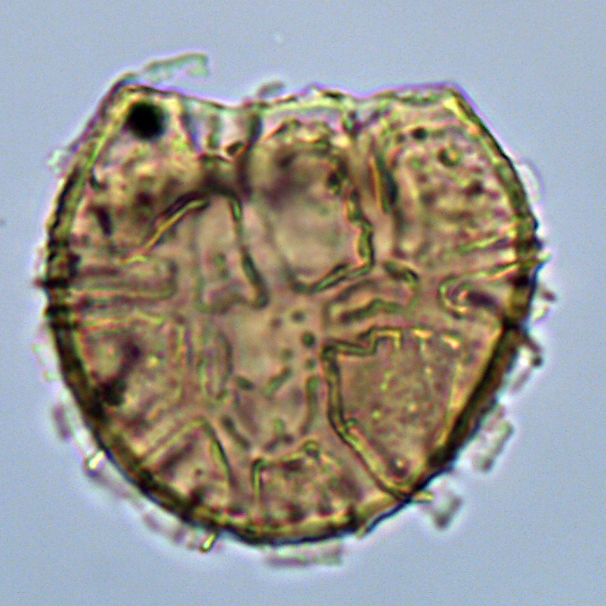 Alisocysta margarita, U1581-19R-1W, 38-42, sl. 1, U23-3, foto-a.jpg